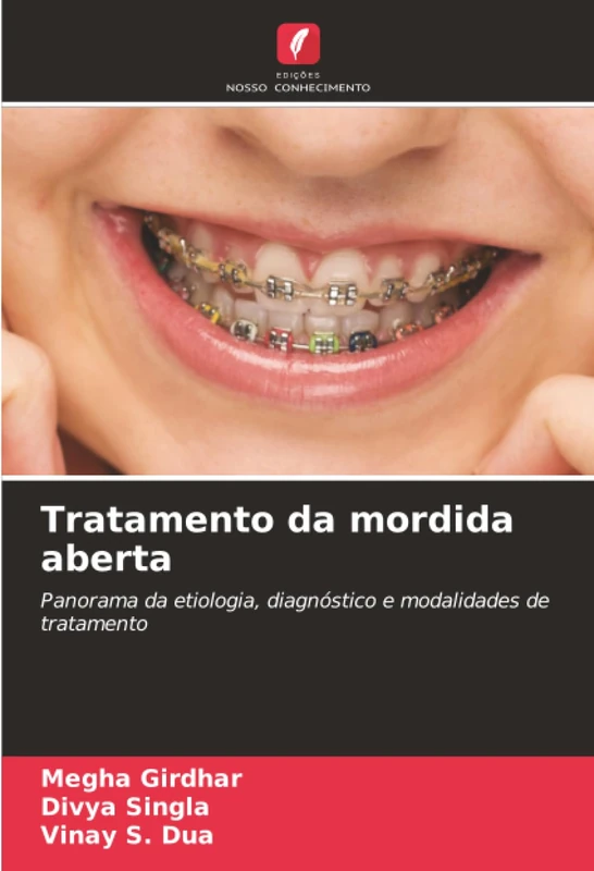 Tratamento da mordida aberta: Panorama da etiologia, diagnóstico e modalidades de tratamento