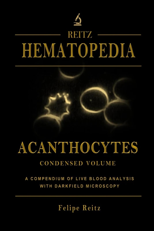 Acanthocytes - Live Blood Analysis and Darkfield Microscopy - Image 1
