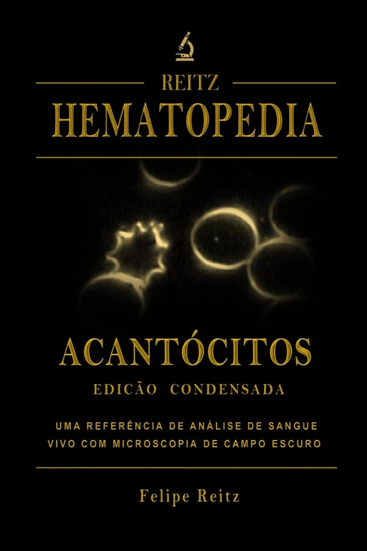Acantocitos Edicao Condensada - Hematopedia Reference Book - Image 1