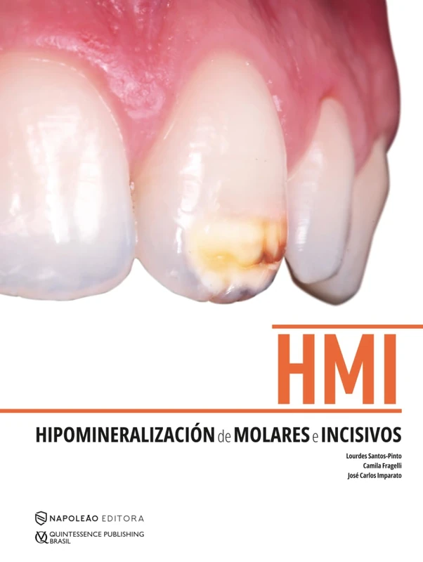 HMI - Hipomineralización de Molares e Incisivos