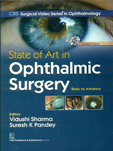 State of Art in Ophthalmic Surgery (CBS Surgical Video Series in Ophthalmology)