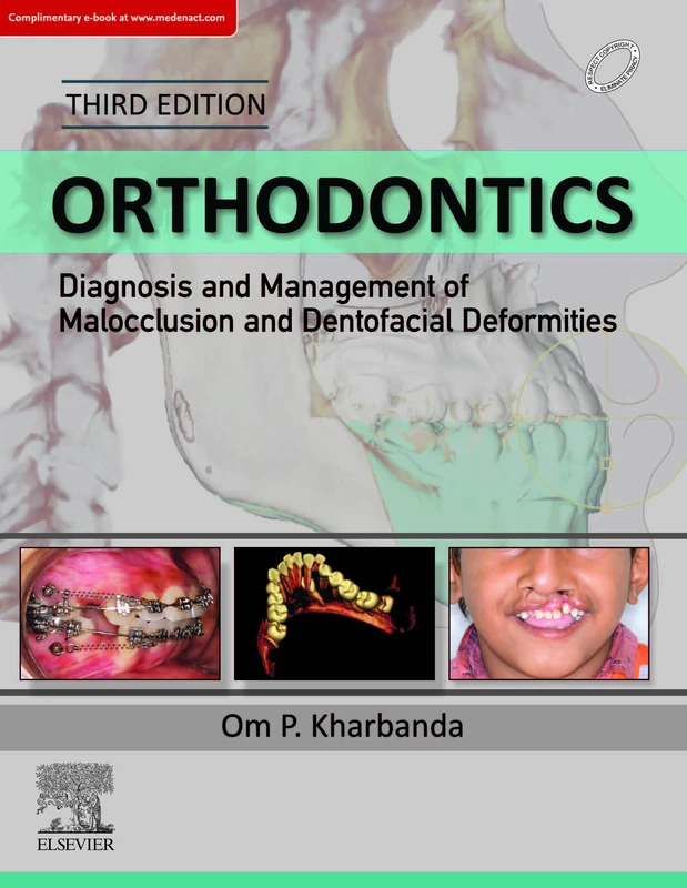 Orthodontics: Diagnosis and Management of Malocclusion and Dentofacial Deformities: Diagnosis of & Management of Malocclusion & Dentofacial Deformities