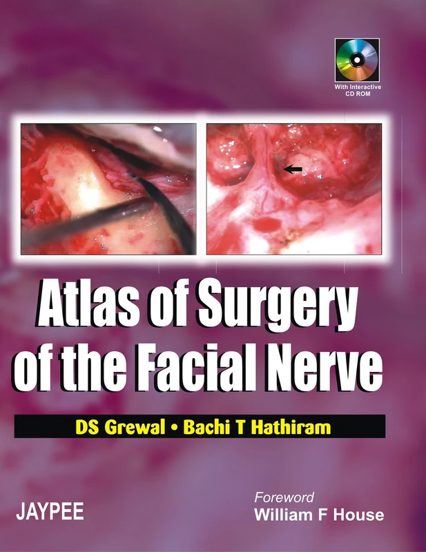 Atlas of Surgery of the Facial Nerve