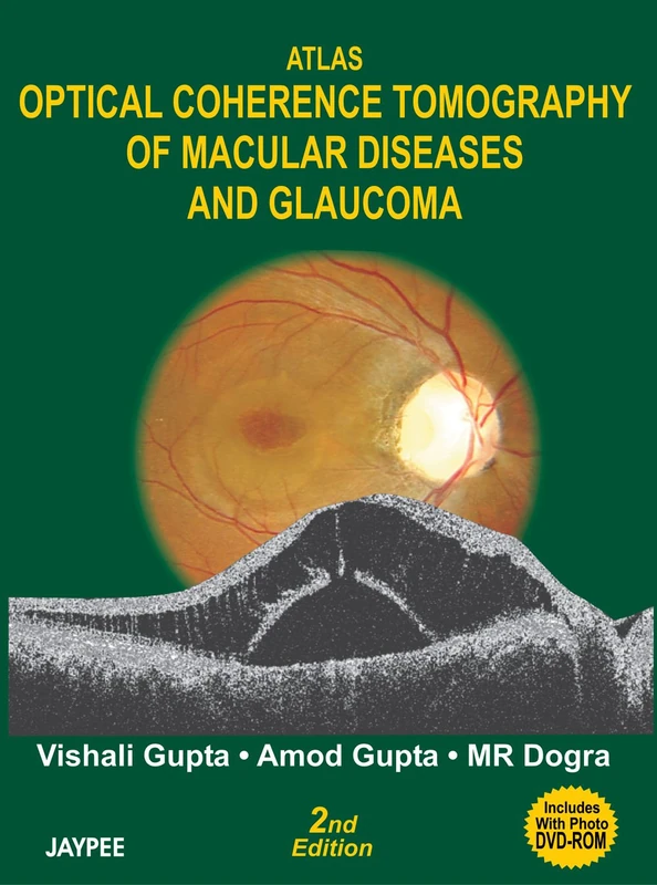 Atlas Optical Coherence Tomography of Macular Dis.
