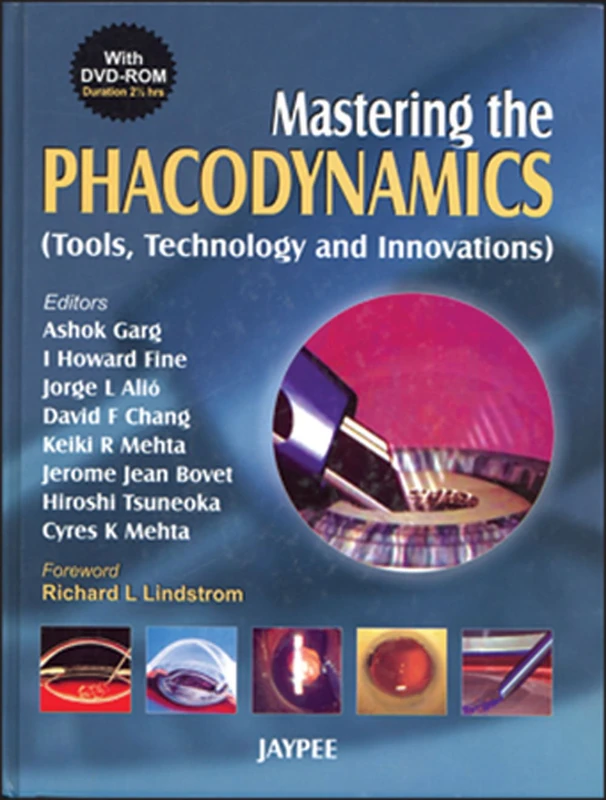 Mastering the Phacodynamics (Tools, Technology and Innovations): Tools, Technology of IOL Power Calculations