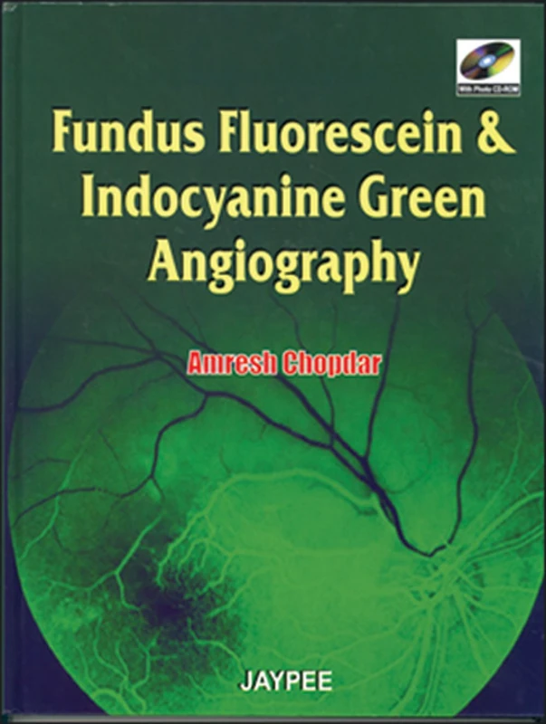 Fundus Fluorescien and Indocyanine 2007: Green Angiography