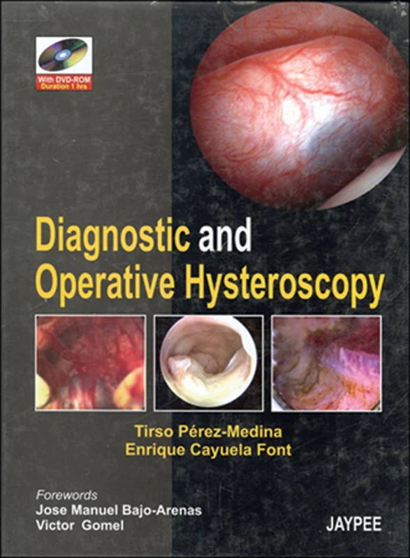 Diagnostic and Operative Hysteroscopic