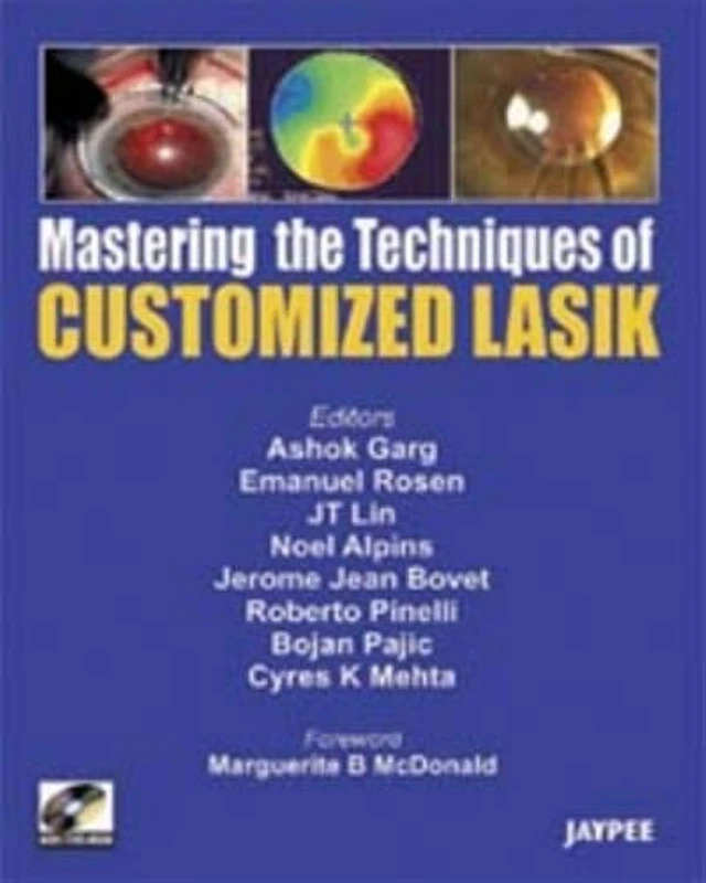 Mastering the Technique of Customized Lasik