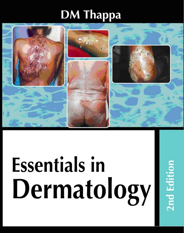 Essentials in Dermatology