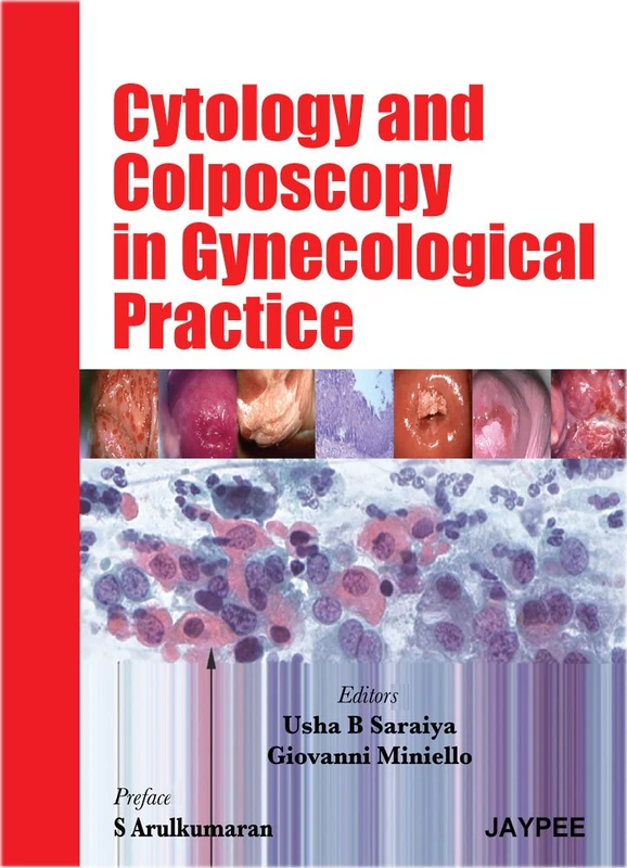 Cytology and Colposcopy in Gynecological Practice