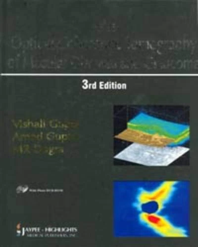Atlas of Optical Coherence Tomography of Macular Disease and Glaucoma