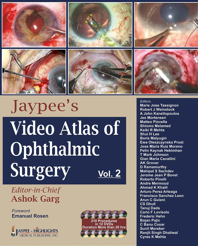 Jaypee's Video Atlas of Ophthalmic Surgery: Volume II (DVDs)