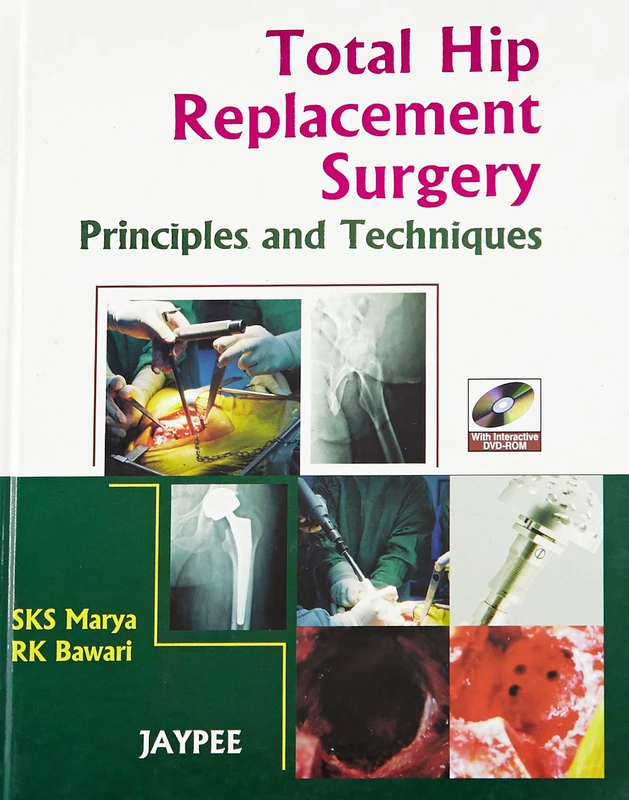 Total Hip Replacement Surgery: Principles & Techniques