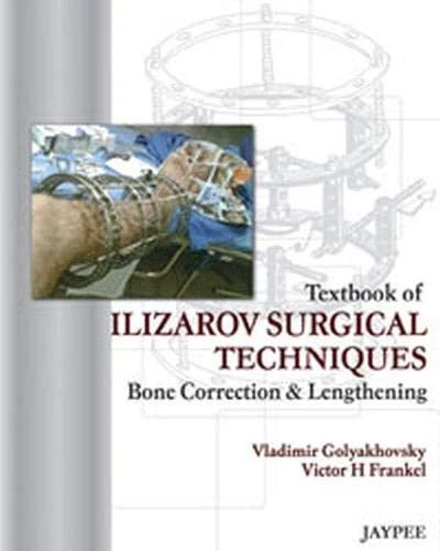 Textbook of Ilizarov Surgical Techniques Bone Correction & Lengthening