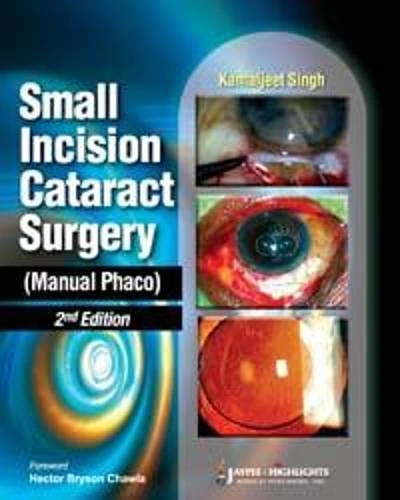 Small Incision Cataract Surgery - Manual Phaco