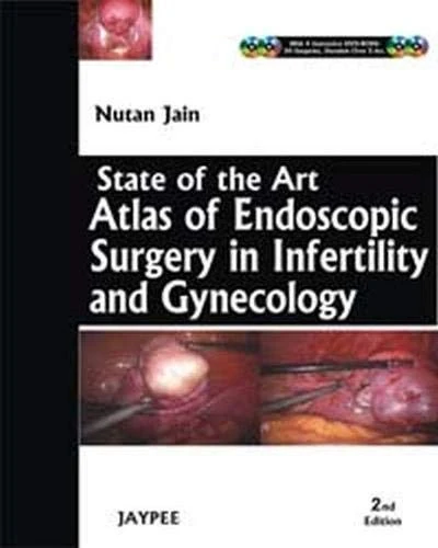 State-of-the-art Atlas of Endoscopic Surgery in Infertility and Gynecology
