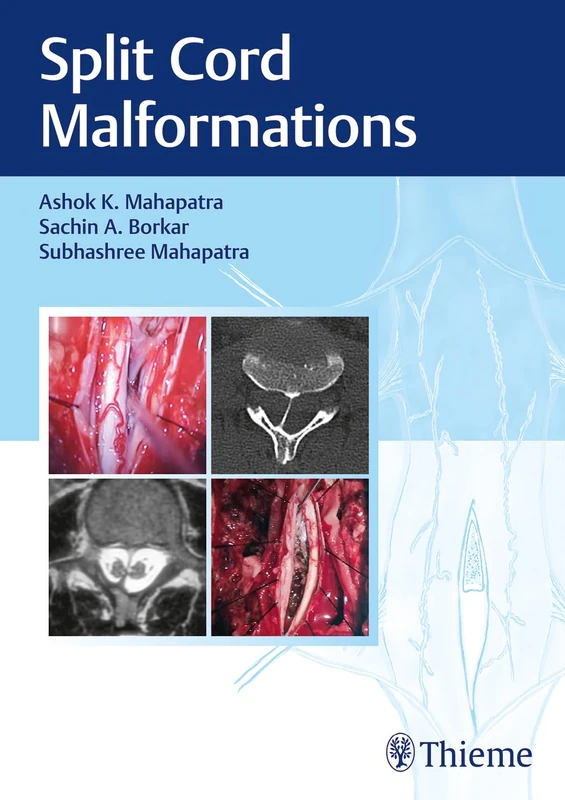 Split Cord Malformations - Image 1