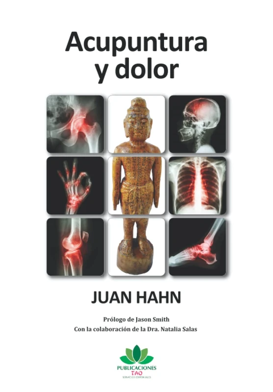 Acupuntura y dolor - Image 1