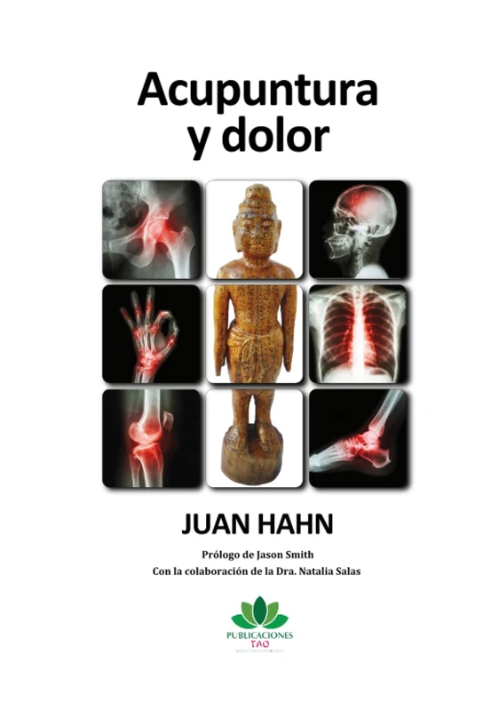 Acupuntura y dolor