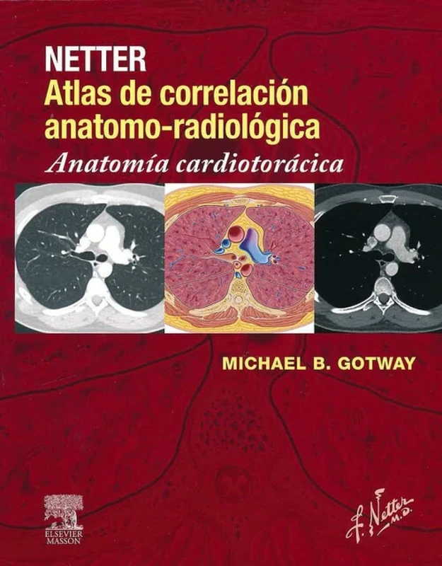 Netter. Atlas de correlación anatomo-radiológica: Anatomía cardiotorácica - Image 1