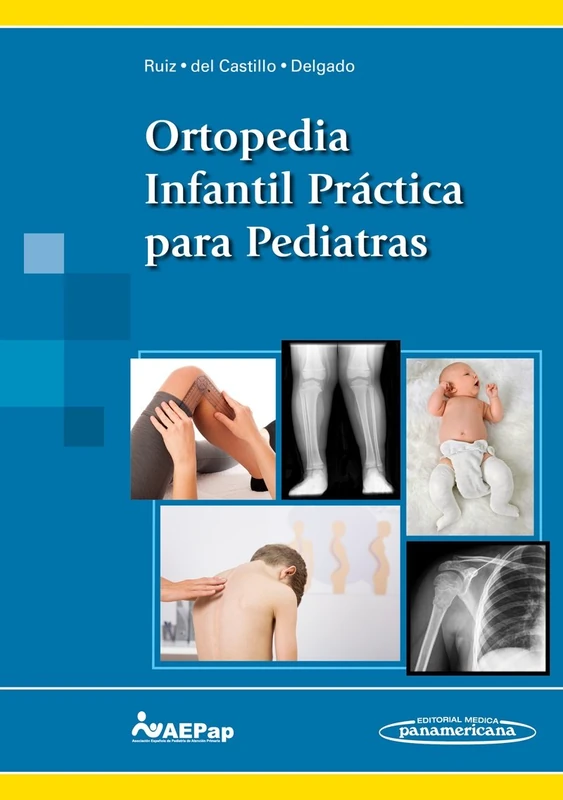 Ortopedia infantil práctica para pediatras