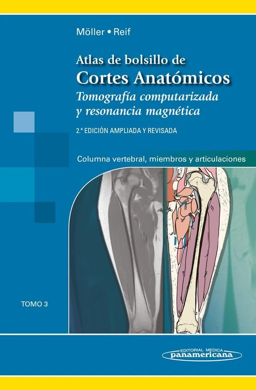 Atlas cortes anatomicos, 2aEd T3: Tomo 3. Tomografía computarizada y resonancia magnética: Columna vertebral, Miembros y Articulaciones