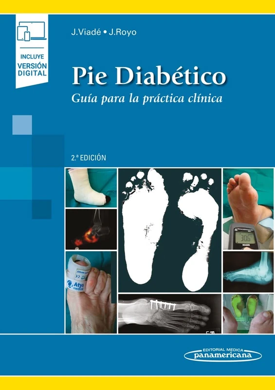 Pie Diabético: Guía para la práctica clínica