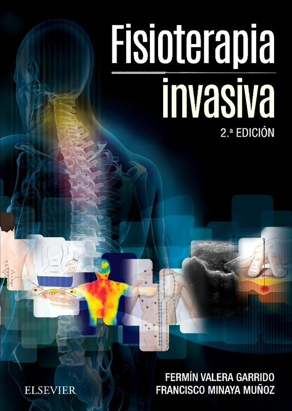 Fisioterapia invasiva - Image 1