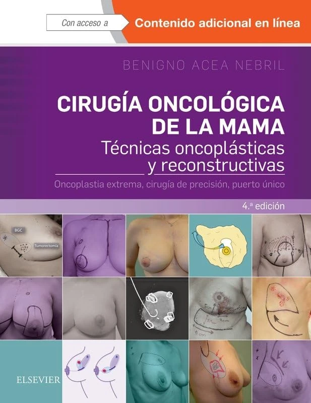 CIRUGÍA ONCOLÓGICA DE LA MAMA.4ª ED. - Image 1