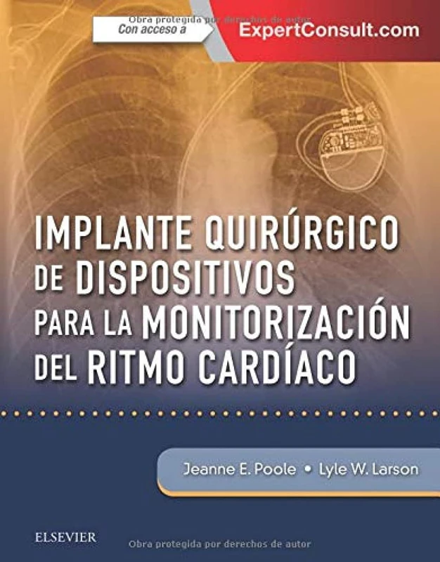 Implante quirúrgico de dispositivos para la monitorización del ritmo cardíaco - Image 1