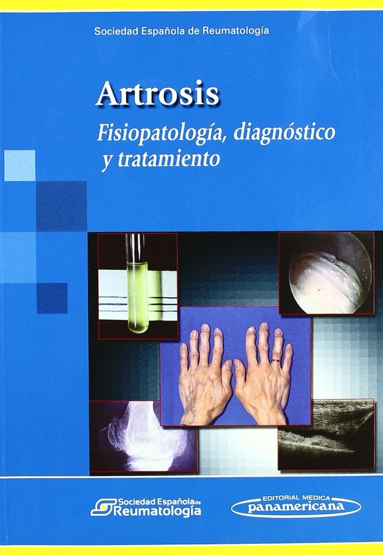 Artrosis / Osteoarthritis: Fisiopatologia, Diagnostico Y Tratamiento / Pathophysiology, Diagnosis and Treatment