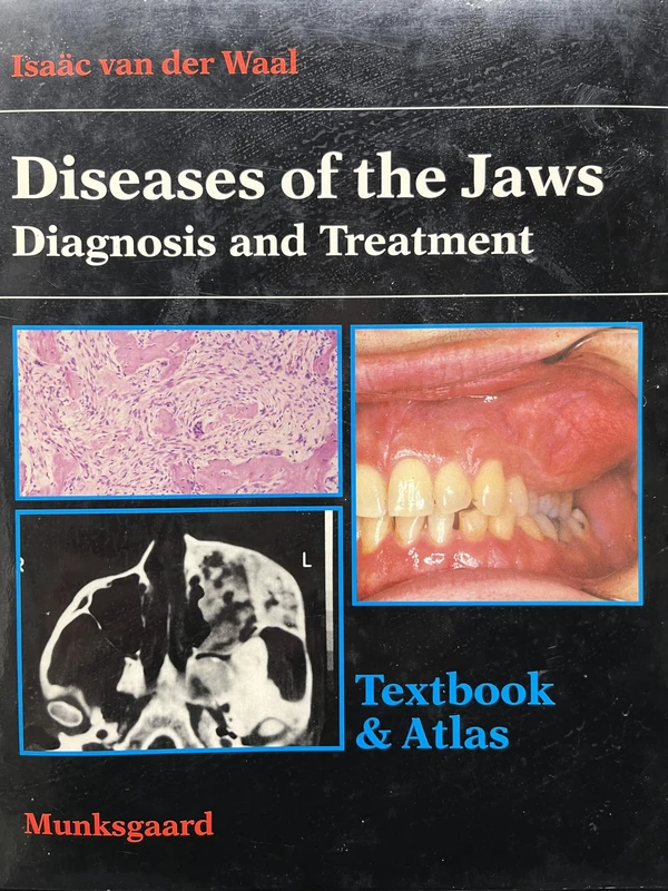 Diseases of the Jaws: Diagnosis and Treatment