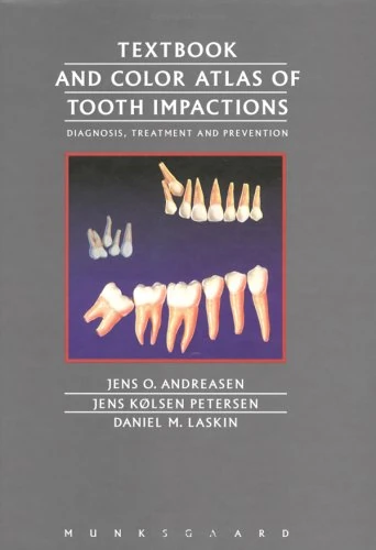 Textbook and Colour Atlas of Tooth Impactions: Diagnosis and Treatment
