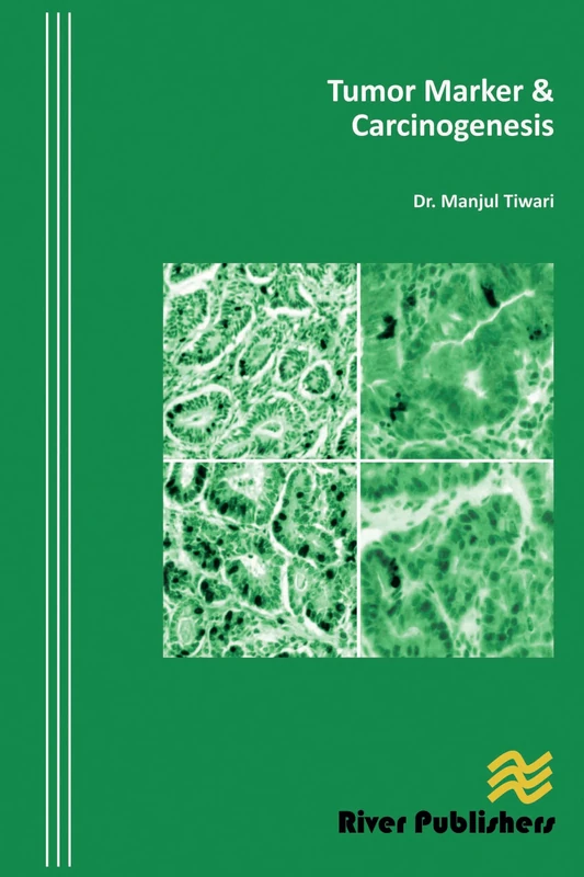 Tumor Marker and Carcinogenesis (River Publishers Series in Research and Business Chronicles: Biotechnology and Medicine)