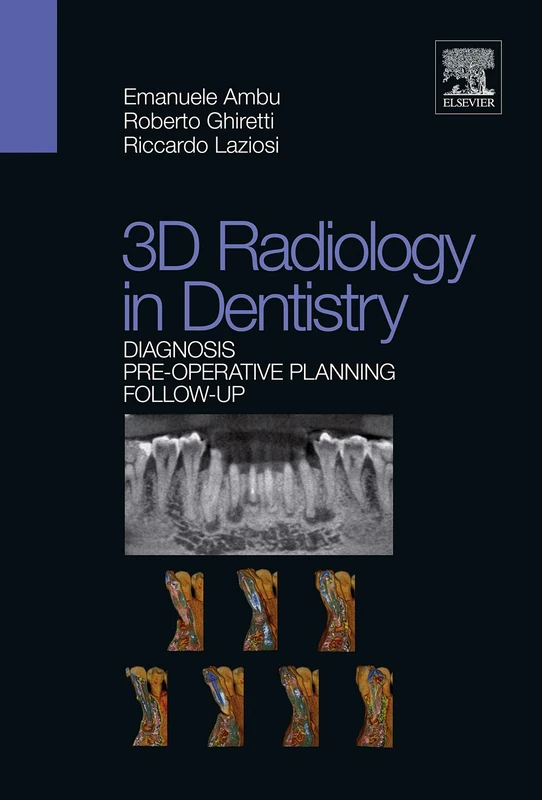 3D radiology in dentistry - Diagnosis Pre-operative Planning Follow-up
