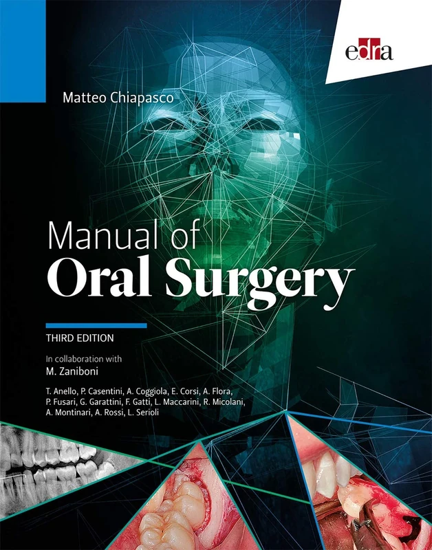 Manual of oral surgery - III Edition