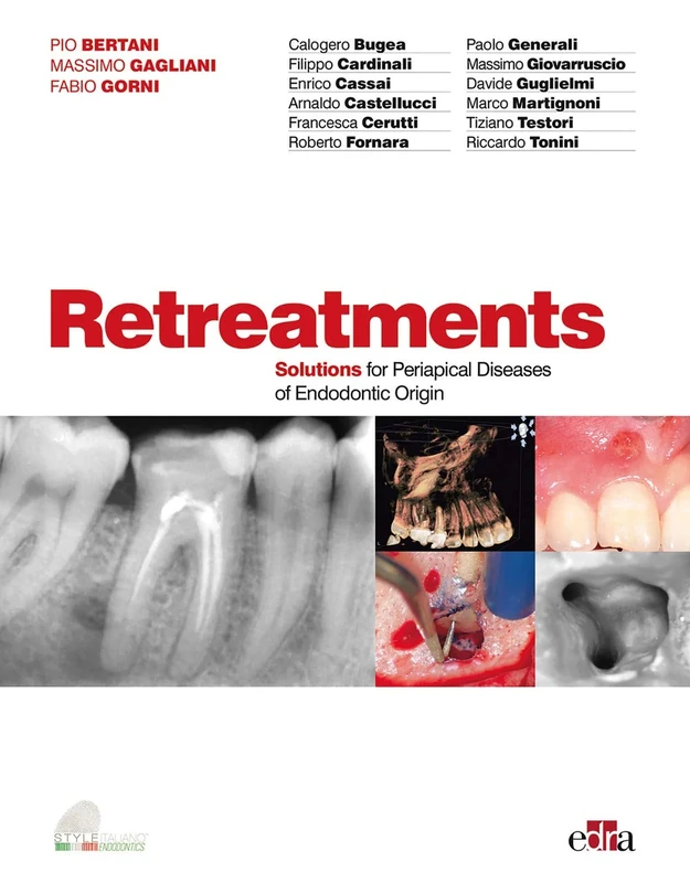 Retreatment - Solutions for apical diseases of endodontic origin: 150