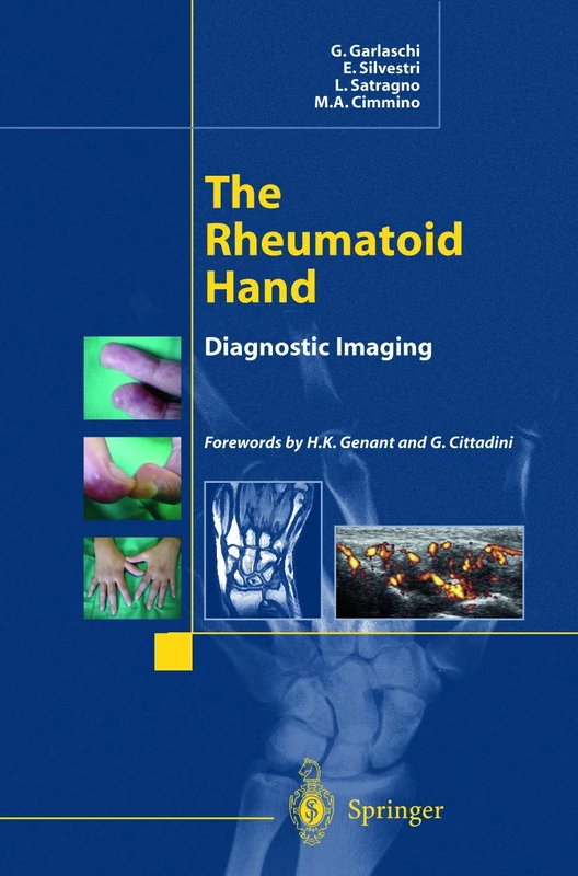 The Rheumatoid Hand: Diagnostic Imaging