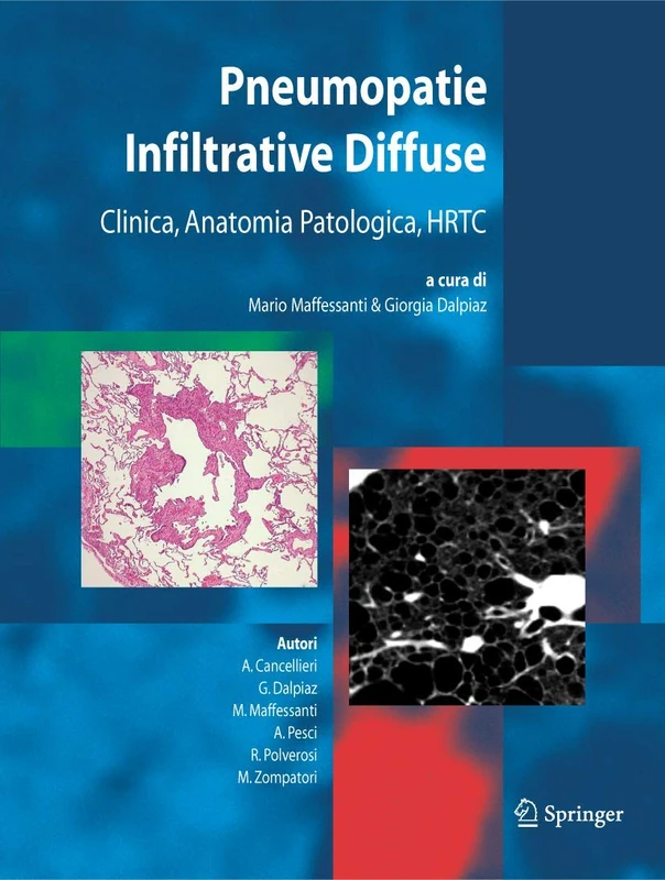 Pneumopatie Infiltrative Diffuse: Clinica, Anatomia Patologica, HRTC