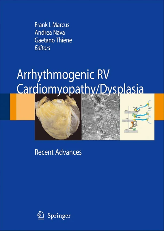 Springer - Arrhythmogenic RV Cardiomyopathy/Dysplasia Book