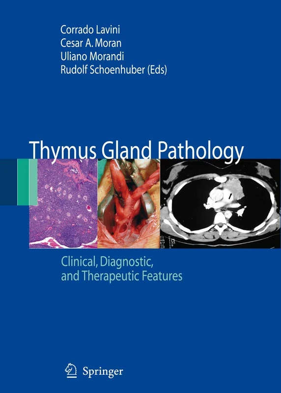 Thymus Gland Pathology: Clinical, Diagnostic and Therapeutic Features - Image 1