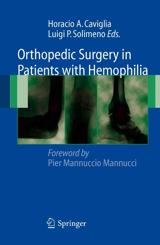 Orthopedic Surgery in Patients with Hemophilia - Image 1