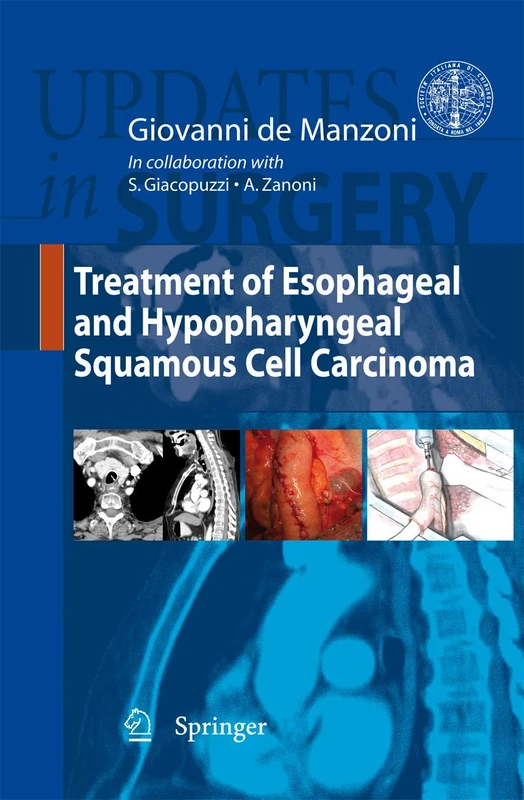 Springer - Treatment of Esophageal Squamous Cell Carcinoma