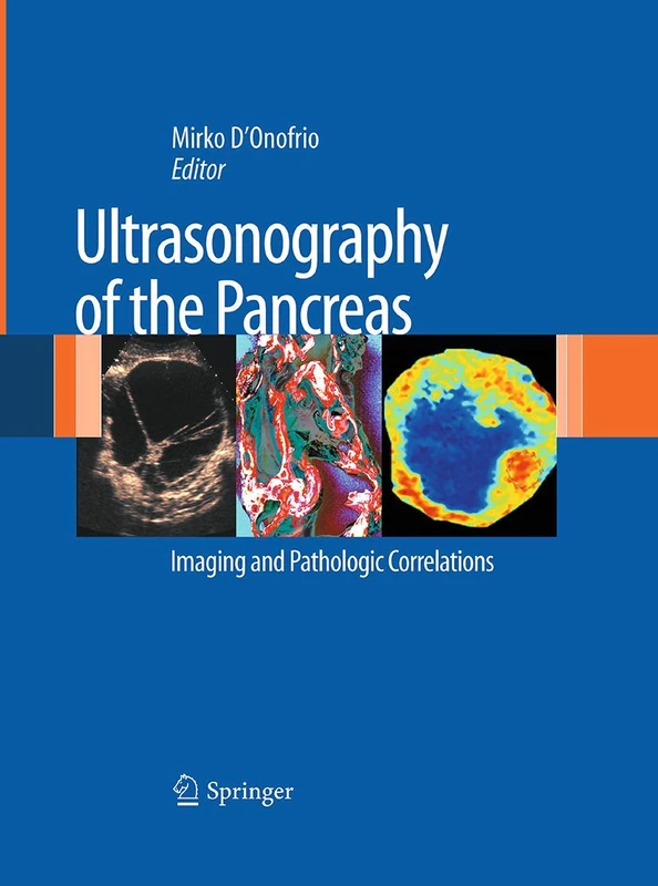 Springer Ultrasonography of the Pancreas - Medical Imaging Book