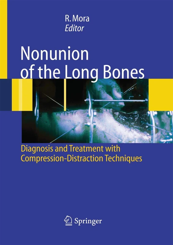 Nonunion of the Long Bones: Diagnosis and treatment with compression-distraction techniques