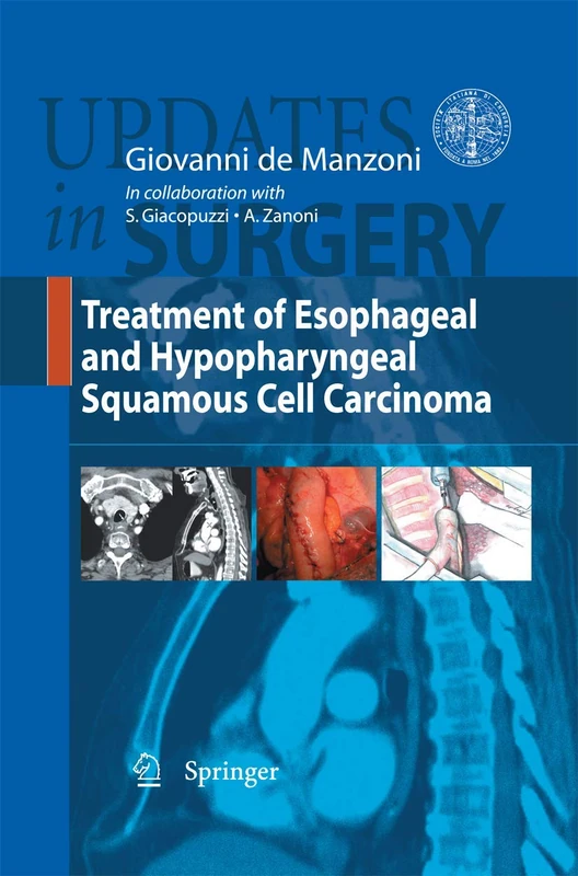 Treatment of Esophageal and Hypopharyngeal Squamous Cell Carcinoma (Updates in Surgery)
