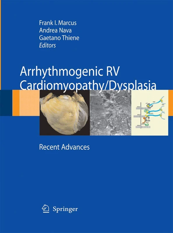 Arrhythmogenic RV Cardiomyopathy/Dysplasia: Recent Advances