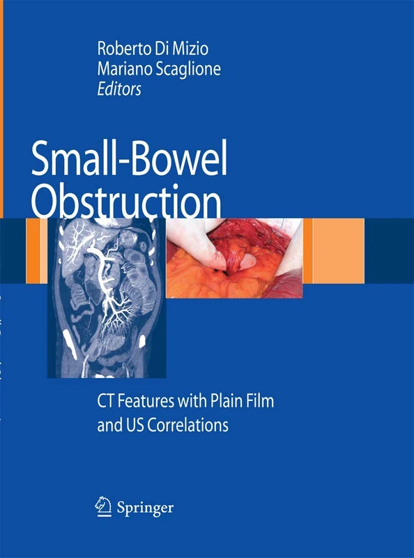 Small-Bowel Obstruction: CT Features with Plain Film and US correlations