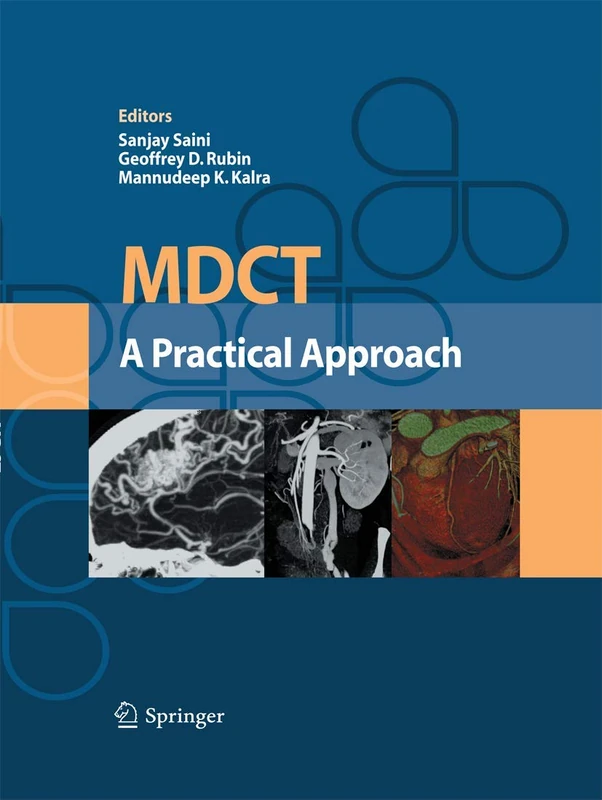 MDCT: A Practical Approach
