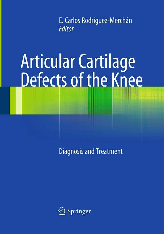 Articular Cartilage Defects of the Knee: Diagnosis and Treatment